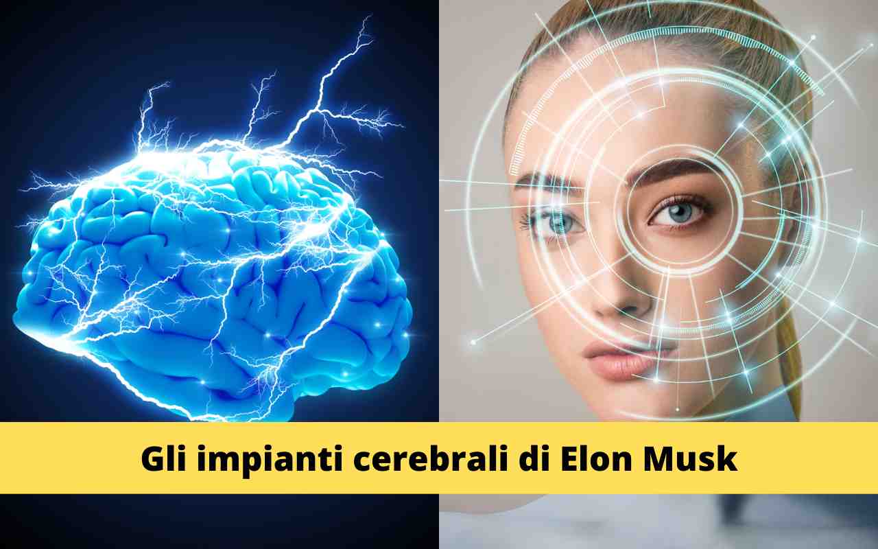 Cervello Neuralink