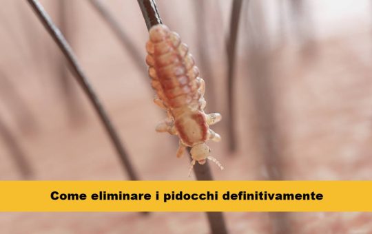 pidocchi