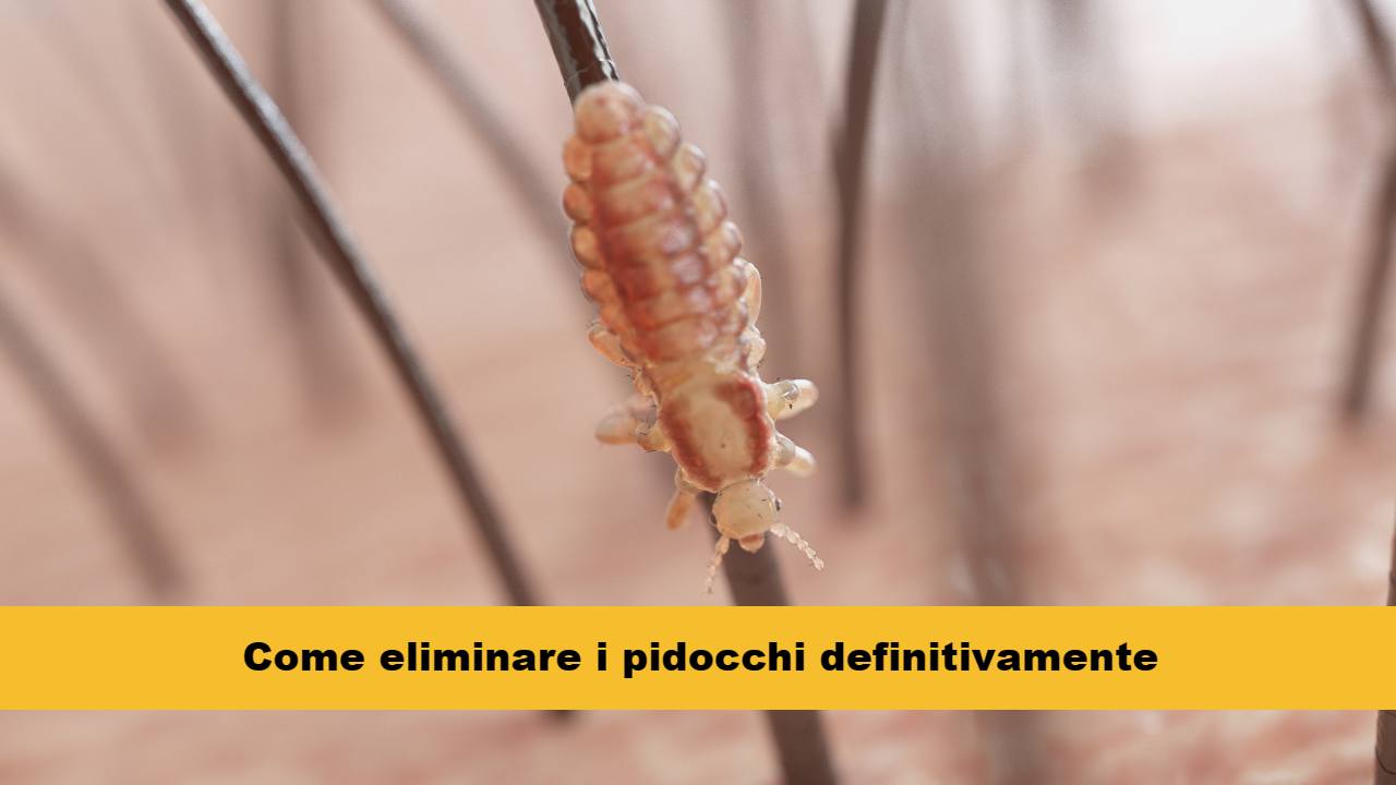 pidocchi