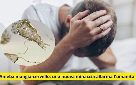 Ameba mangia-cervello